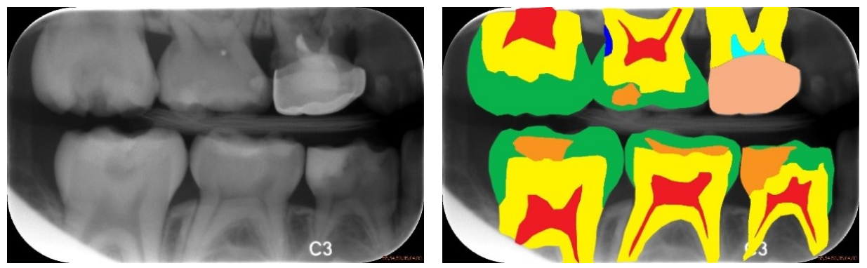 Semantic Segmentation Example